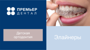 элайнеры исправление прикуса Тюмень