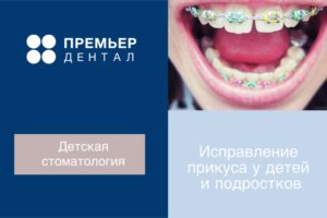 брекеты тюмень исправить прикус ребенку