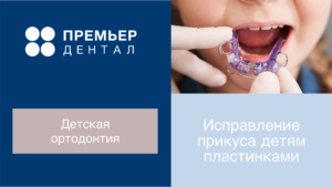исправление прикуса детям пластинками
