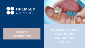Кольцо с распоркой ортодонт Тюмень