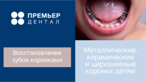 коронки молочные зубы тюмень детям