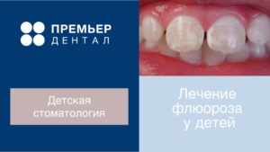 лечение флюороза у детей тюмень
