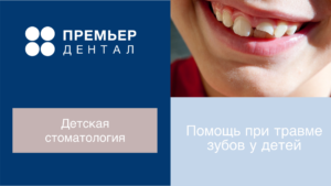 Стоматологическая помощь при травмах зубов