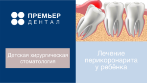 лечение перикоронарита детям