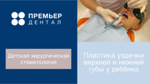 Подрезание уздечки губы лазером