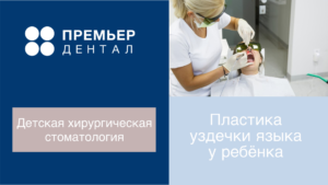 подрезать уздечку ребёнку в тюмени